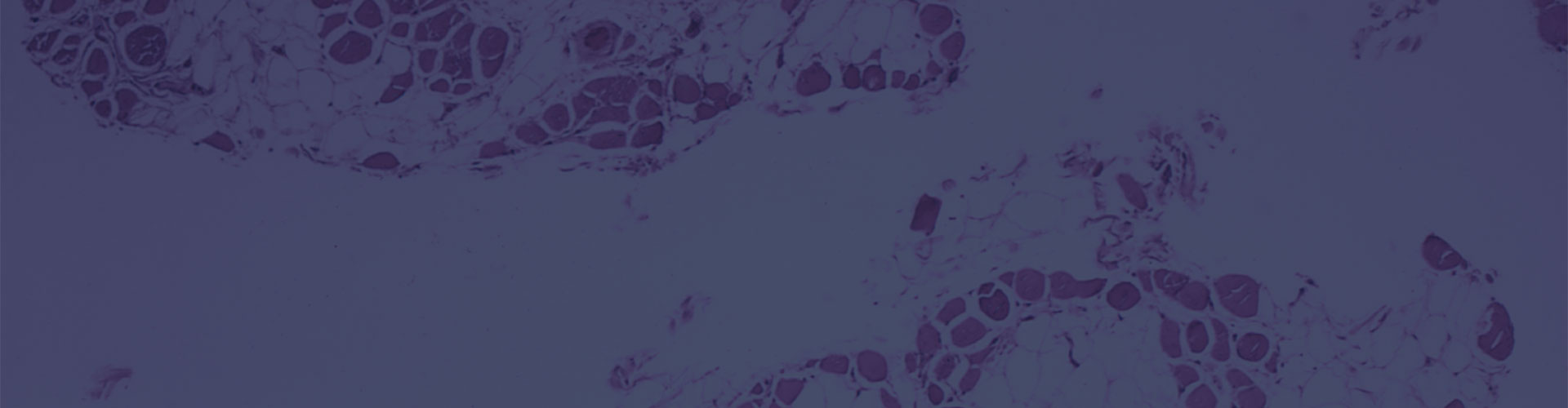 What Is FSHD?